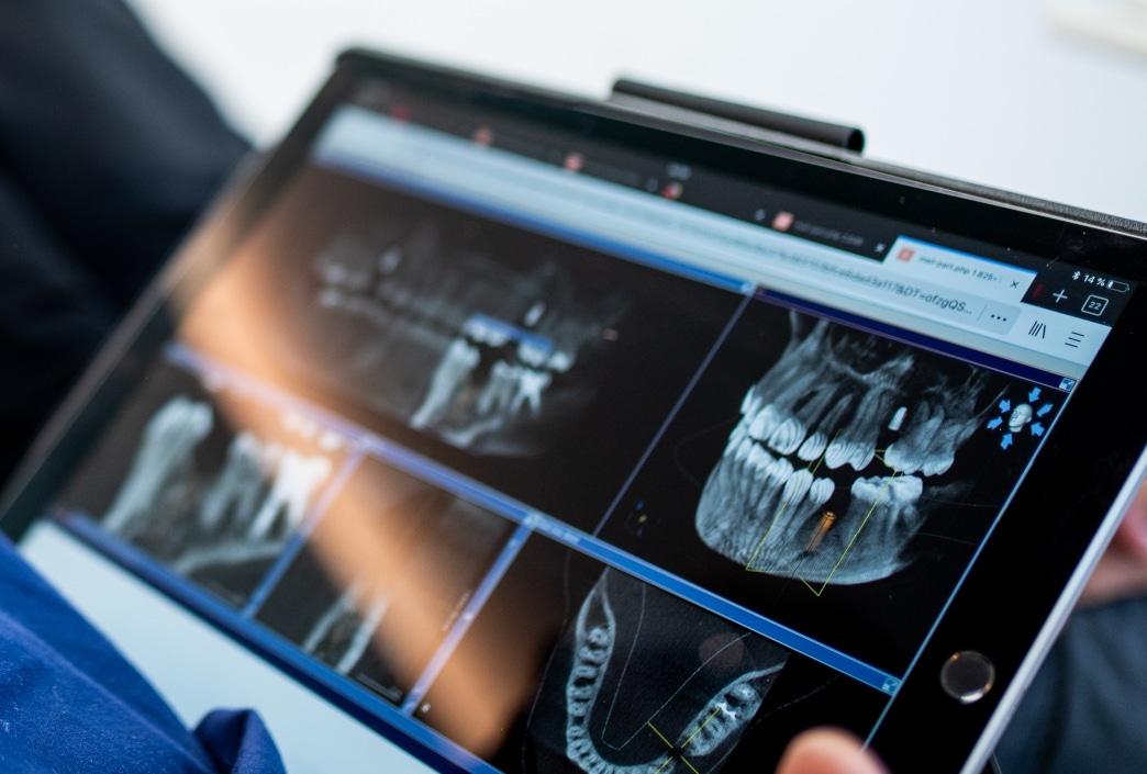 Erfolgreiche Oralchirurgie Freiburg dank 3D-Diagnostik